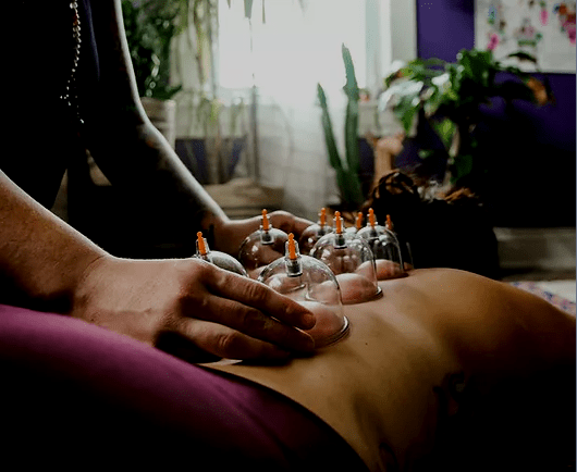 Therapeutic bodywork, massage, massage in Louisville, KY, cupping, yoga